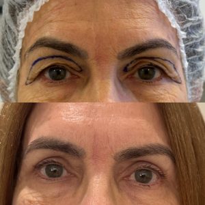 WhatsApp Image 2025-11-10 at 15.46.51 (3)